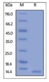 SDS-PAGE (CD9-3867H).jpg